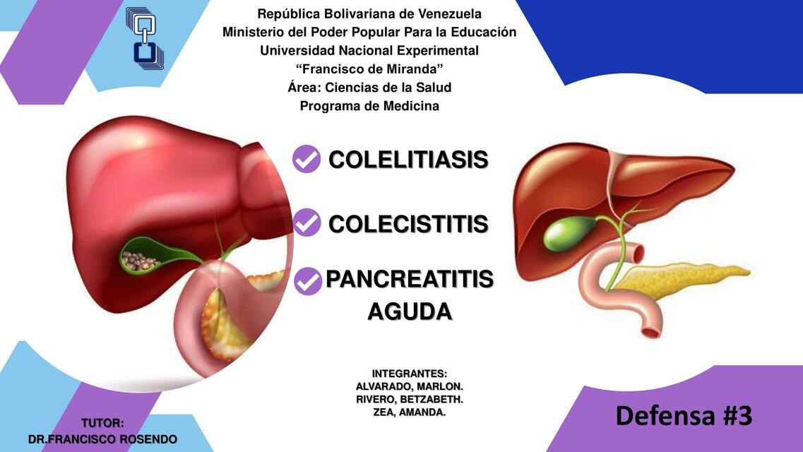 Colecistitis - colelitiasis - pancreatitis aguda