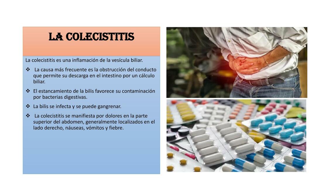 La Colecistitis 