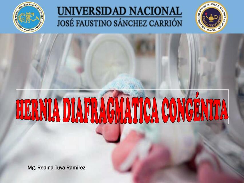 Hernia diafragmática congénita 