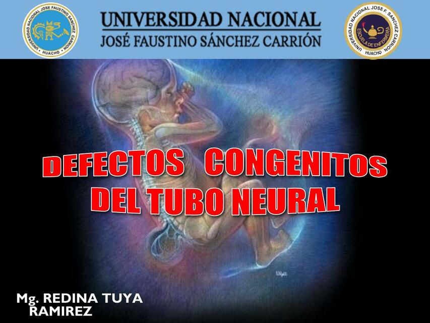 Malformaciones del tubo neural 