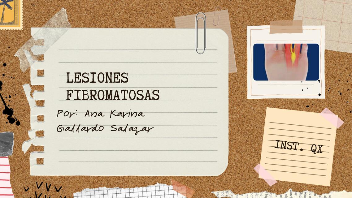 Lesiones fibromatosas