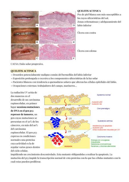 Neoplasias epiteliales malignas