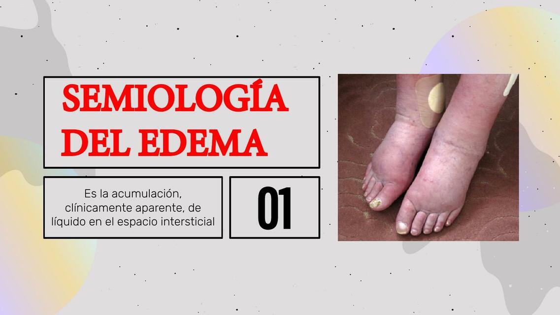 Semiología del Edema 