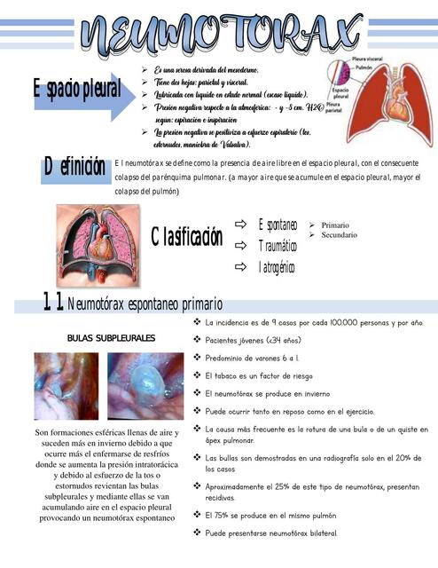 Neumotórax 