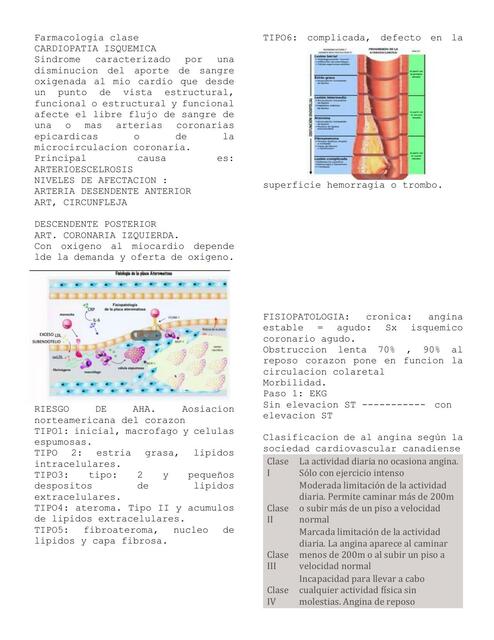 Cardiopatía Isquémica 