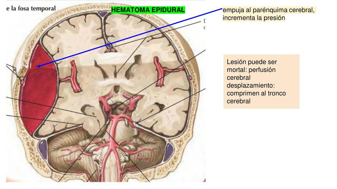 Sistema Nervioso Central 36 Bosque UDocz sistema-nervioso-central-36-bosque-udocz