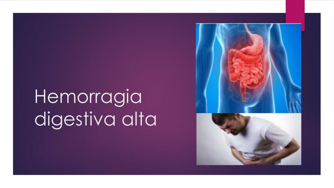 Hemorragia Digestiva Alta 