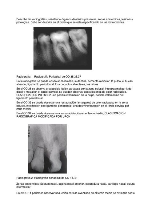 Interpretación Radiográfica