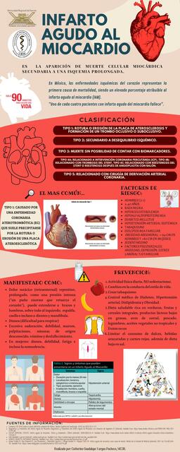 Infarto Agudo Al Miocardio Catherine Vargas Udocz 1677