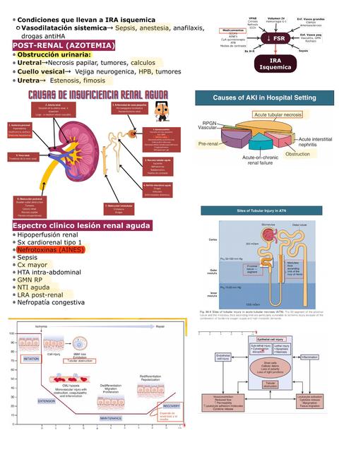 Lesión Renal Aguda Udocz