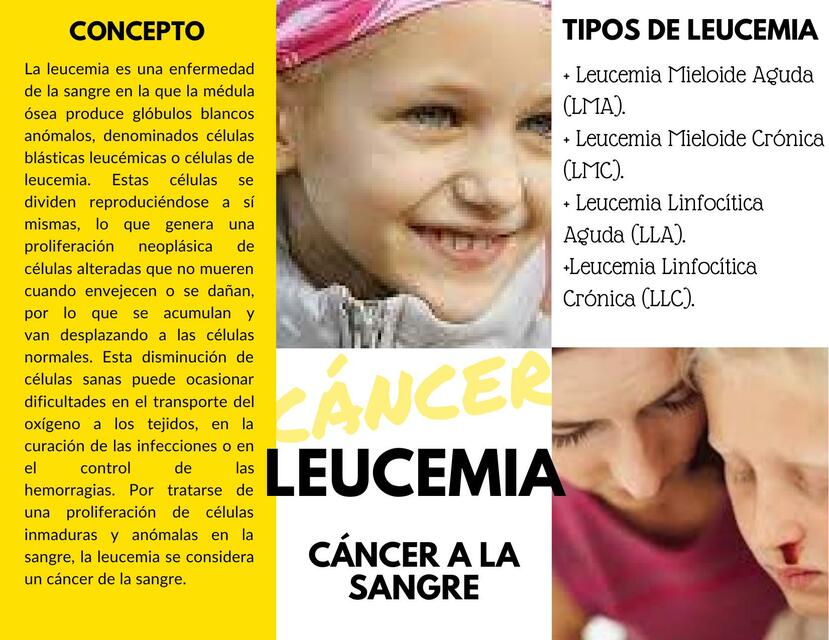 Cáncer a la sangre: Leucemia