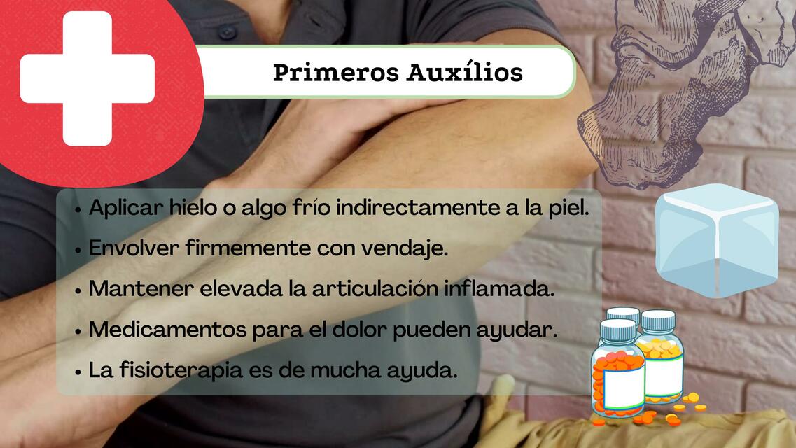 Primeros Auxilios En Caso De Un Esguince Linda Milena León Gómez Udocz