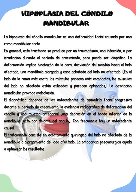Hipoplasia del cóndilo mandibular | Alan Díaz | uDocz