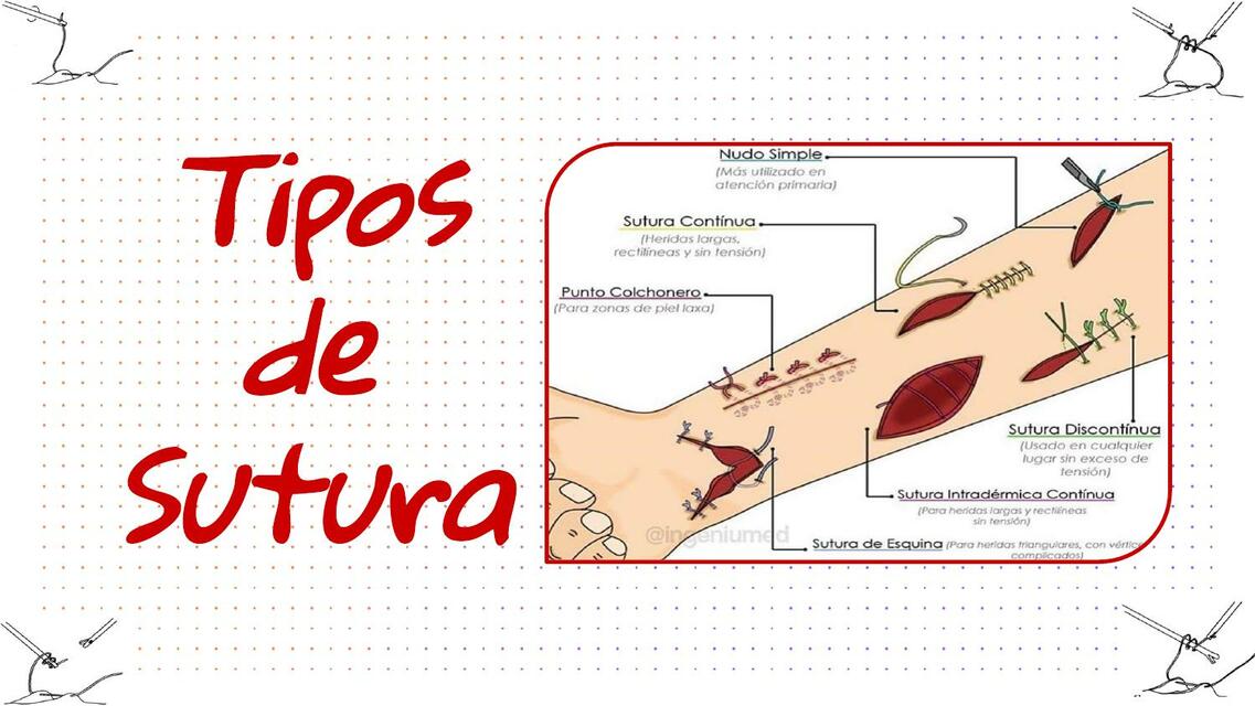 Tipos De Suturas Udocz