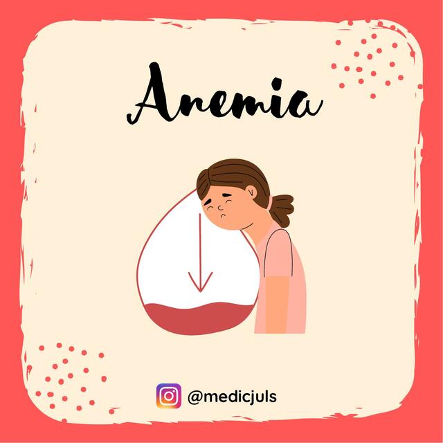 Anemia 