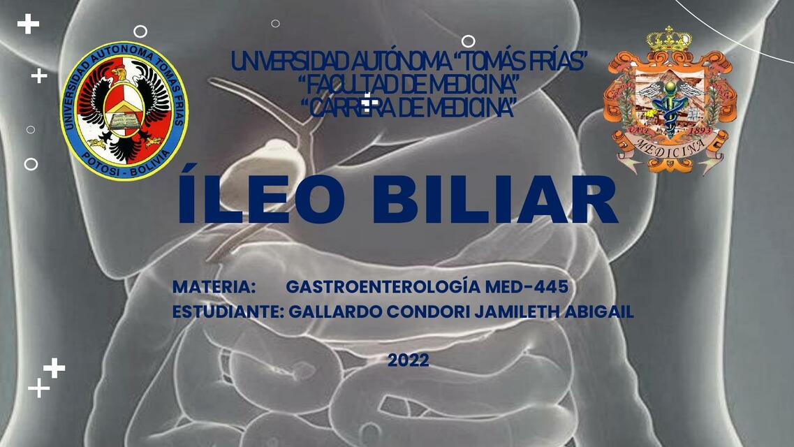 íleo Biliar 