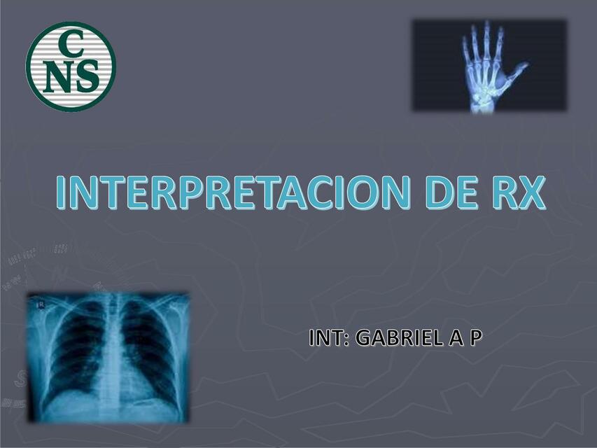 Resúmenes de Interpretación de RX | Descarga apuntes de Interpretación ...
