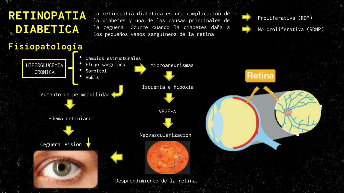 Complicaciones Crónicas de la Diabetes Mellitus 