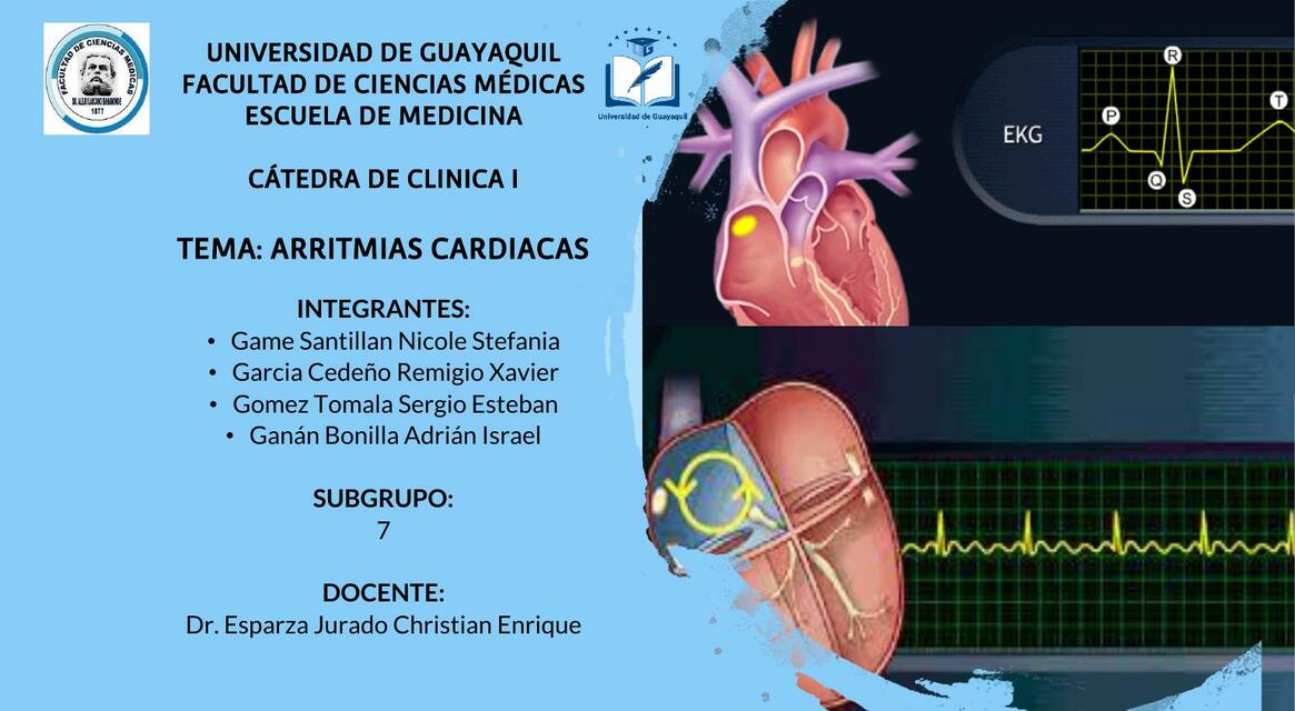 Arritmias Cardiacas 