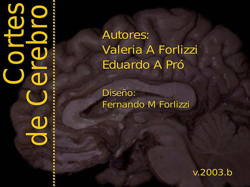 CORTES DEL CEREBRO | Zenayda Alfaro | uDocz