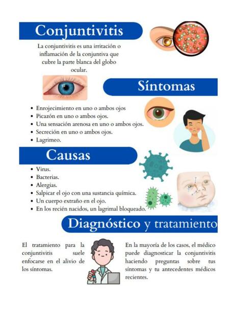 Conjuntivitis 