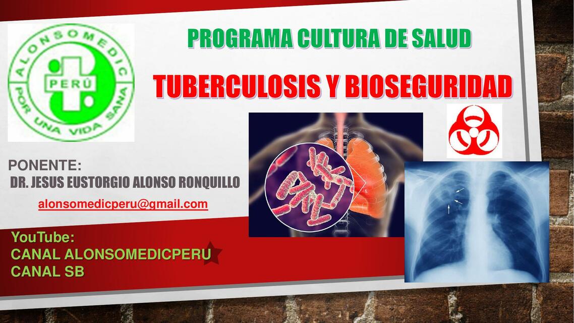 Tuberculosis y Bioseguridad 