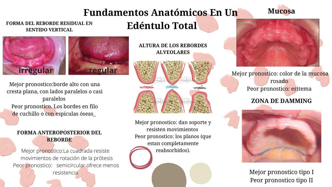 Fundamentos Anatómicos en un Edéntulo Total