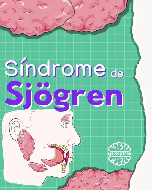 Síndrome de Sjögren