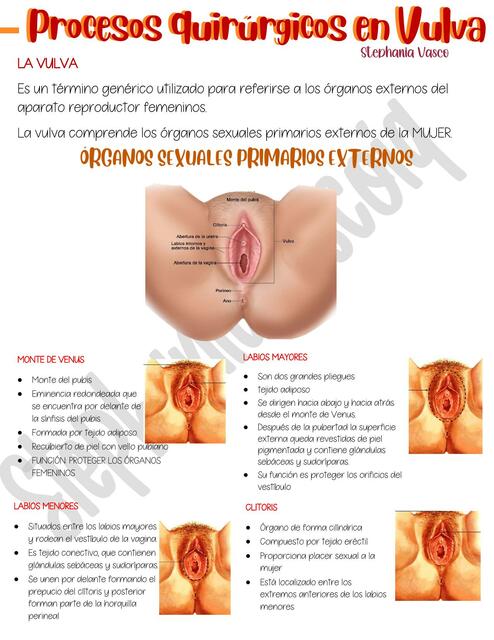 Procesos Quirúrgicos en Vulva 