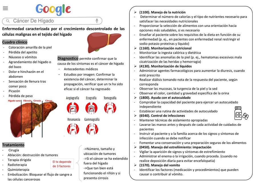 Cáncer de Hígado 