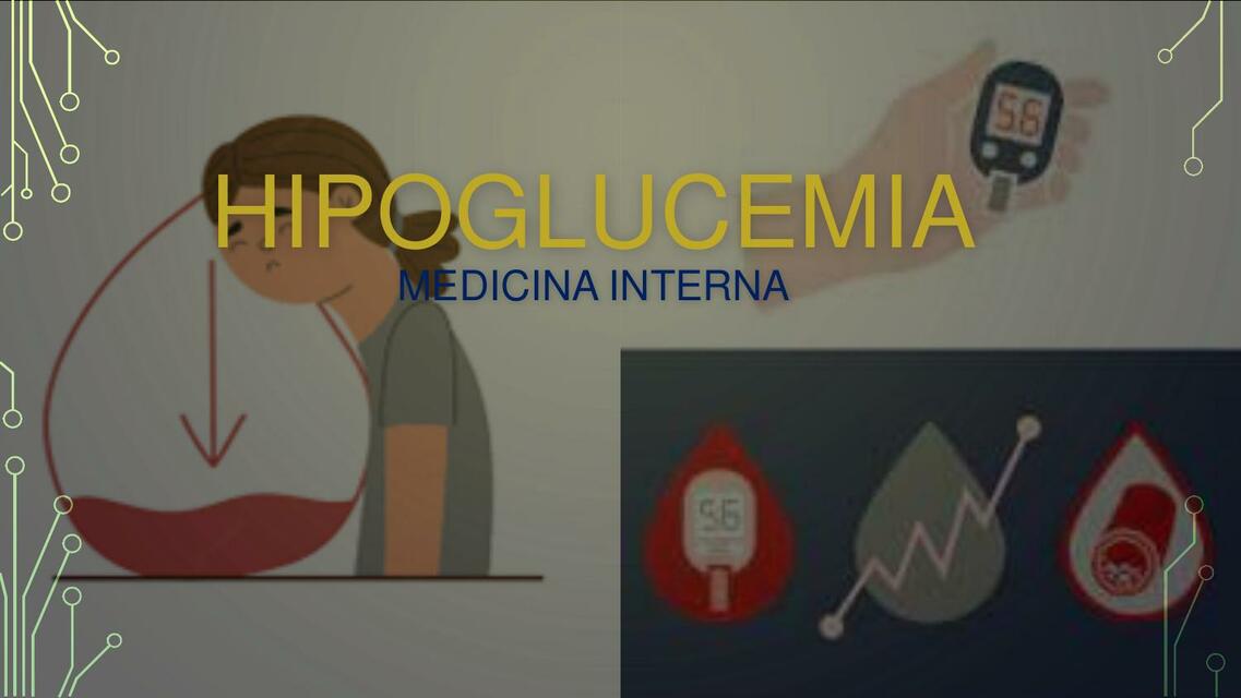 Hipoglucemia 