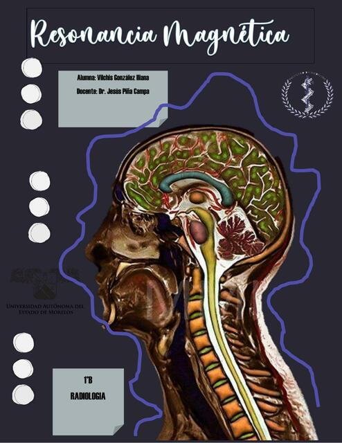 Resonancia Magnética 