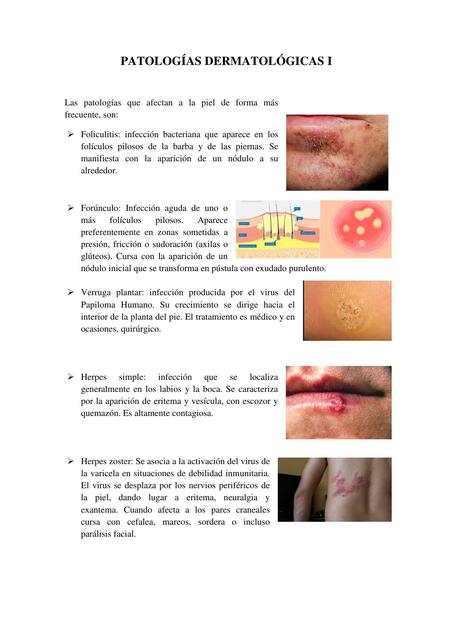 Patologías Dermatológicas I