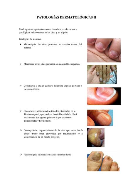 Patologías Dermatológicas II