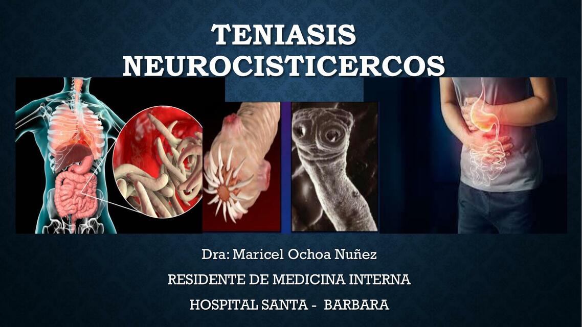 Teniasis Neurocisticercos