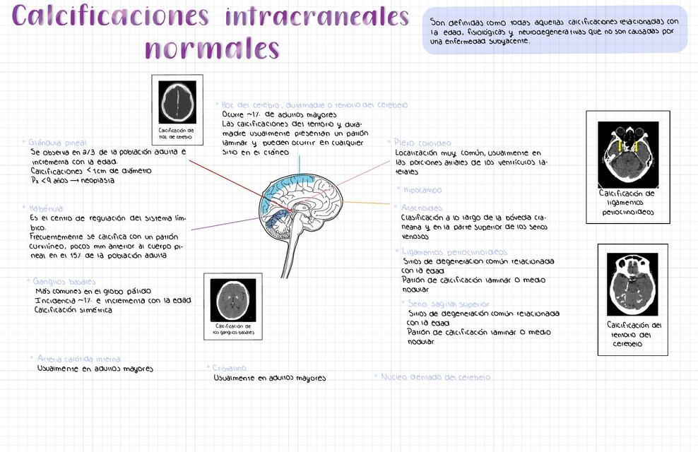 Calcificaciones Intracraneales Normales