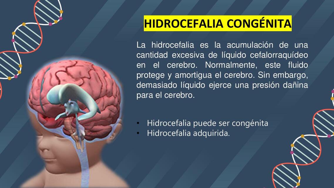 Hidrocefalia congénita