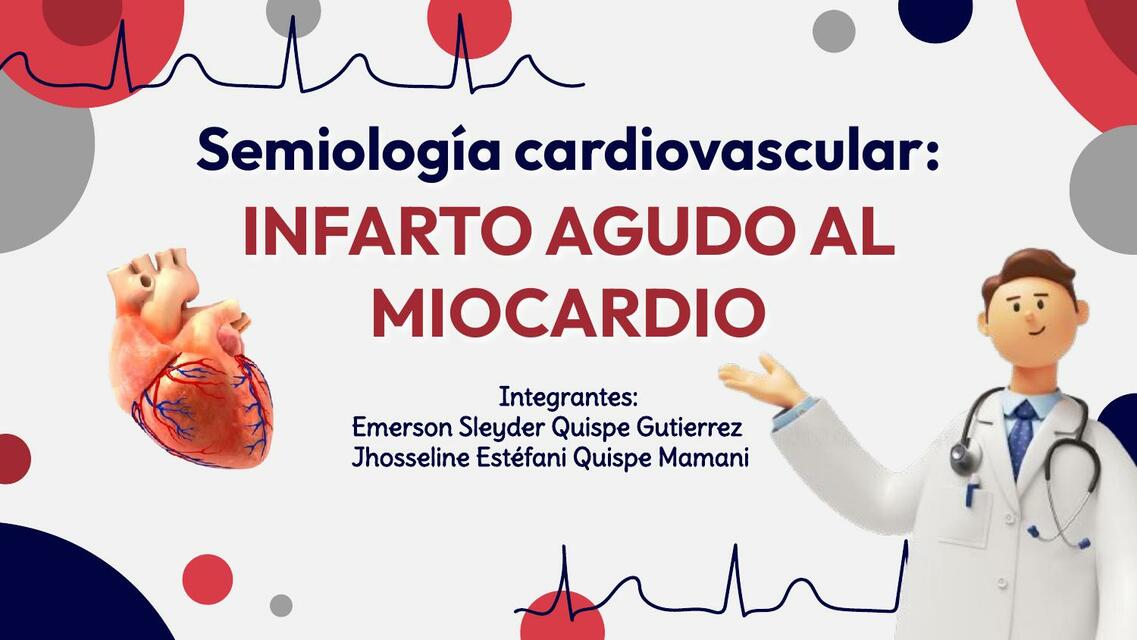 Infarto agudo al miocardio