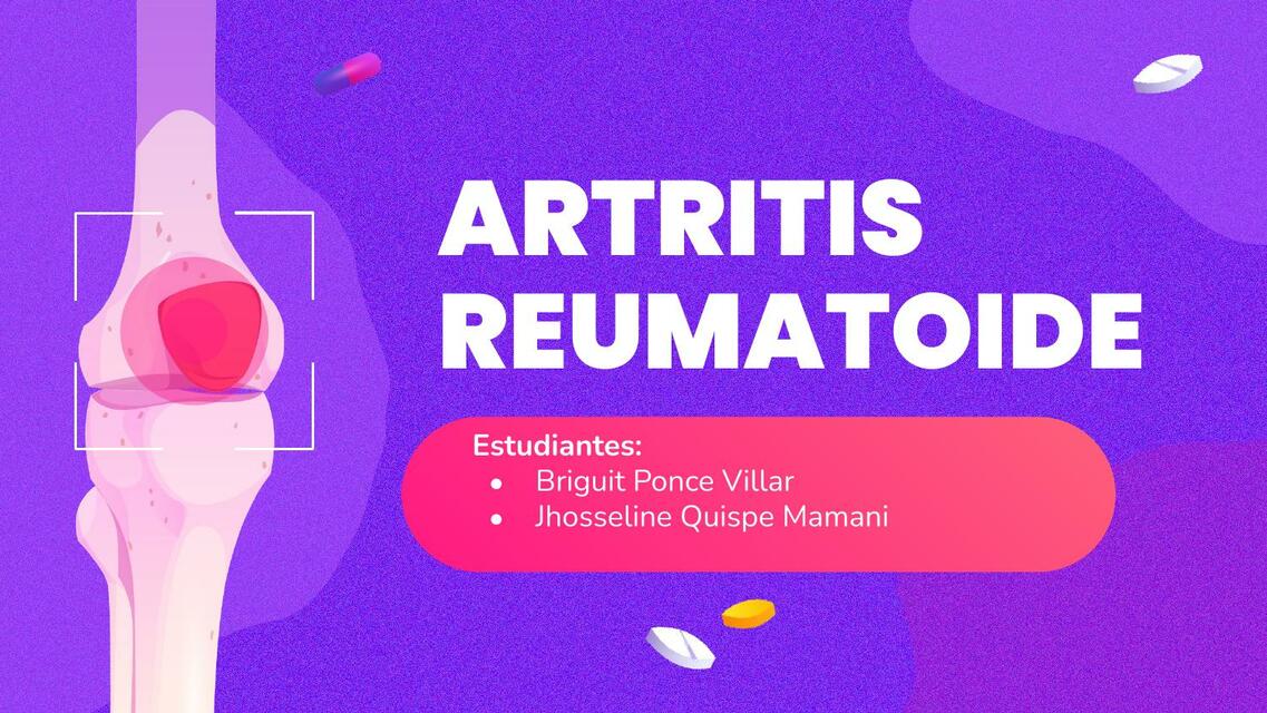 Artritis reumatoide 