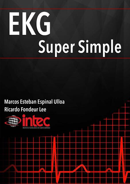 EKG Super Simple