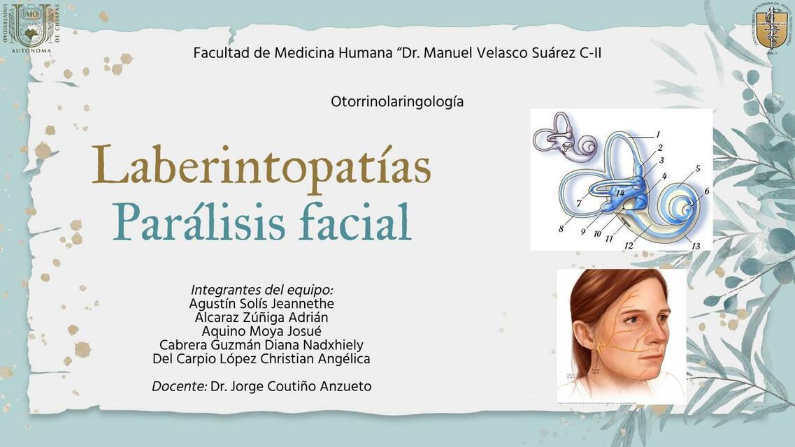 Laberintopatías y Parálisis Facial