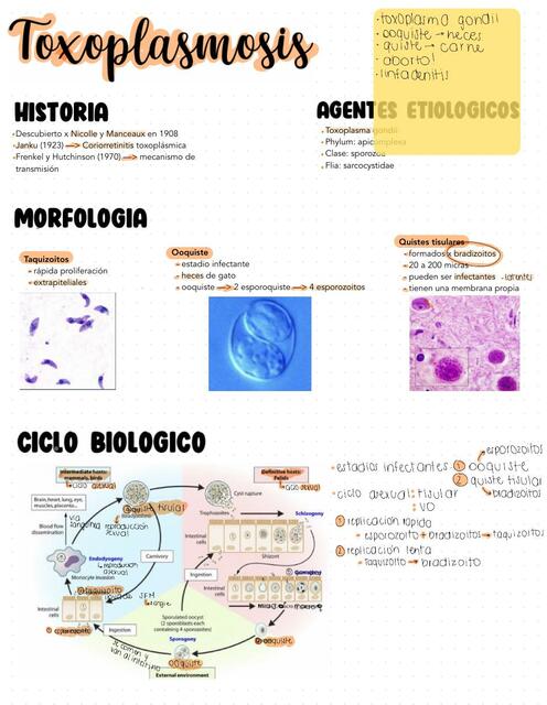 Toxoplasmosis