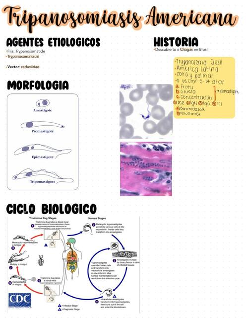 Enfermedad de Chagas