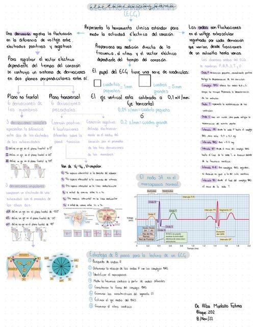 Esquema EKG