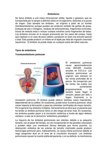 Embolismo