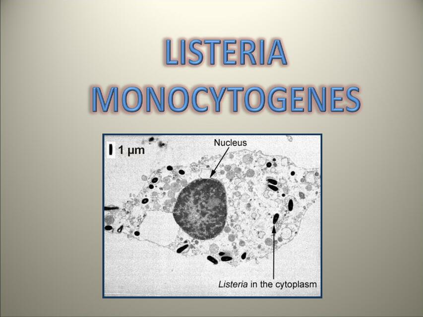 Listeria Monocytogenes RESÚMENES MÉDICOS uDocz
