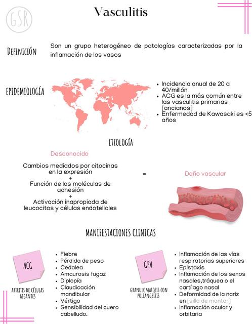 Vasculitis