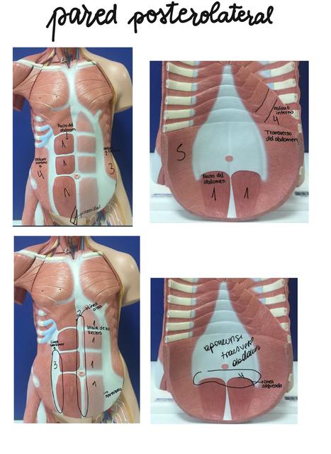 Pared posterolateral  