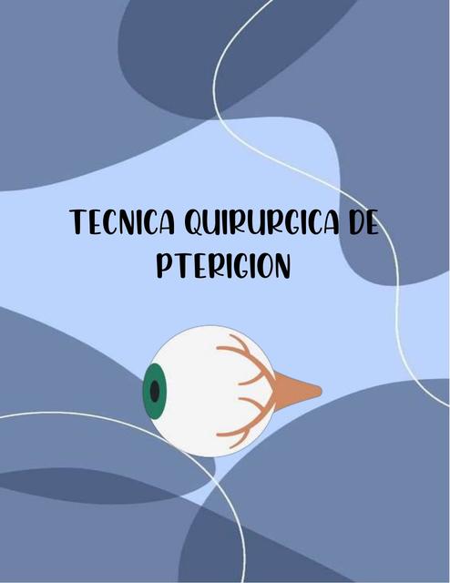 Técnica quirúrgica de pterigión