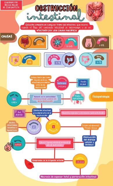 Obstrucción Intestinal